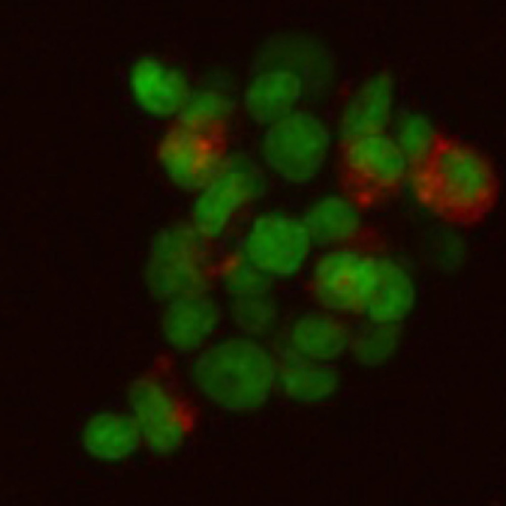 Клетки костного мозга на матриксе из регенерированного фиброина шелка. Ядра выявлены SYBR Green, показаны зеленым. Gr-1 (granulocyte differentiation antigen 1) выявлен антителами к Gr-1, конъюгированными с PE, показан красным. Изображение получено с использованием конфокальной системы Nikon A1 в рамках совместной работы д.б.н. Недоспасова С.А., к.б.н. Друцкой М.С. и к.б.н. Мойсеновича М.М.